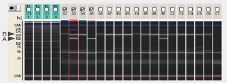 SNP Typing of ABCC11 Gene Using MultiNA (Gel Image)